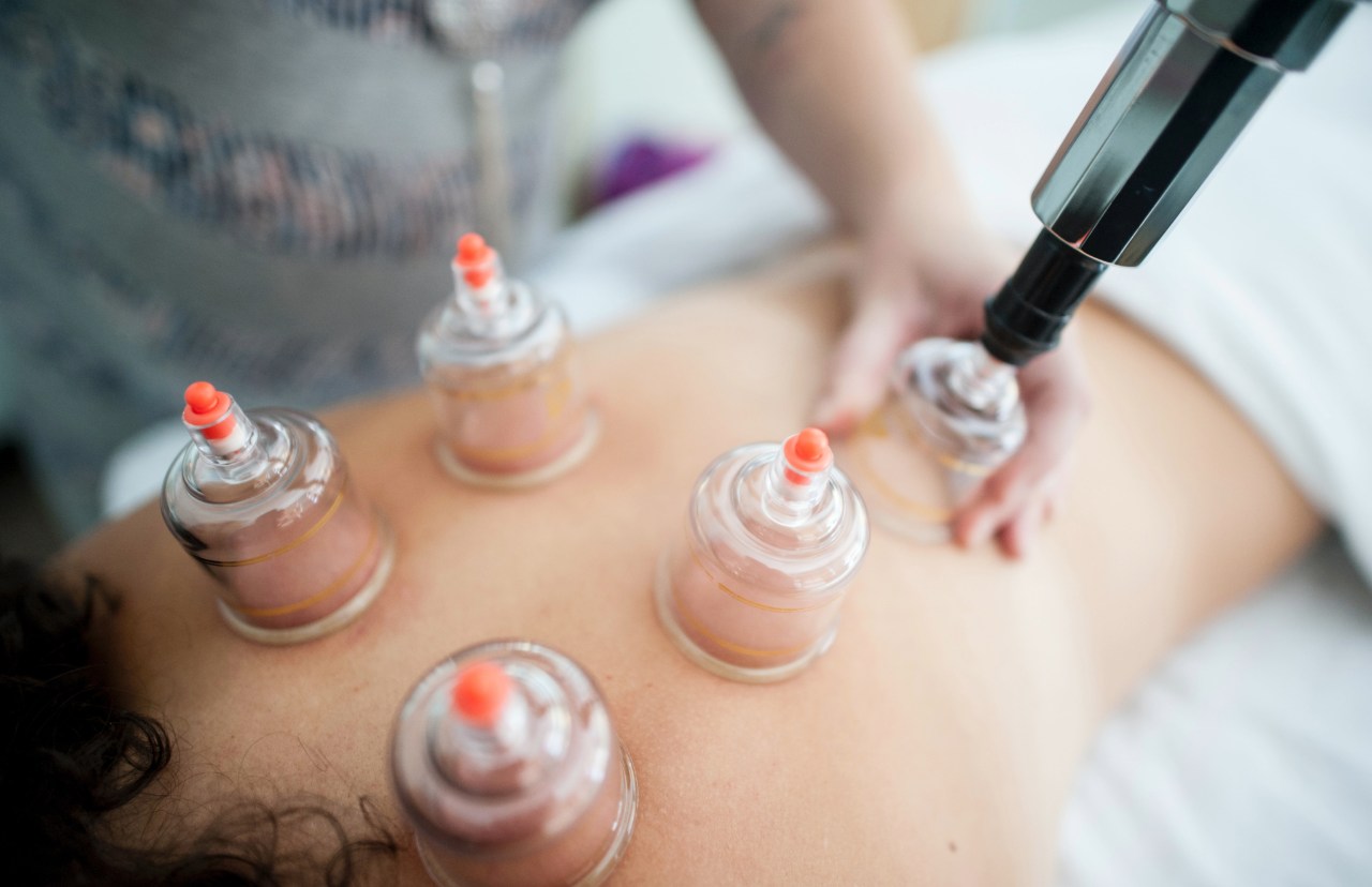 Cupping Massage (RMT)